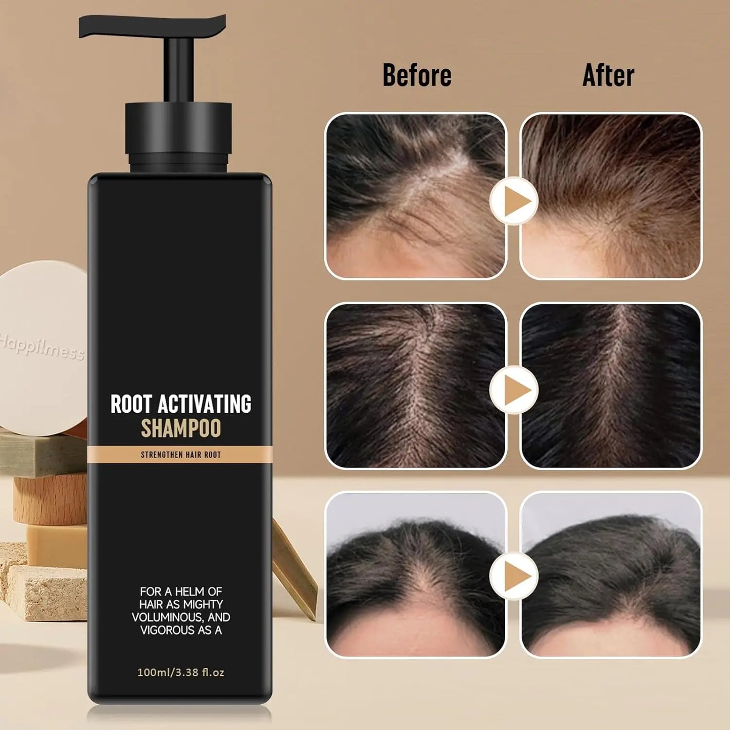 Root Activator Shampoo - Hair Growth Root Activator Shampoo for Men and Women - Natural Formula for Hair Loss and Thinning Hair