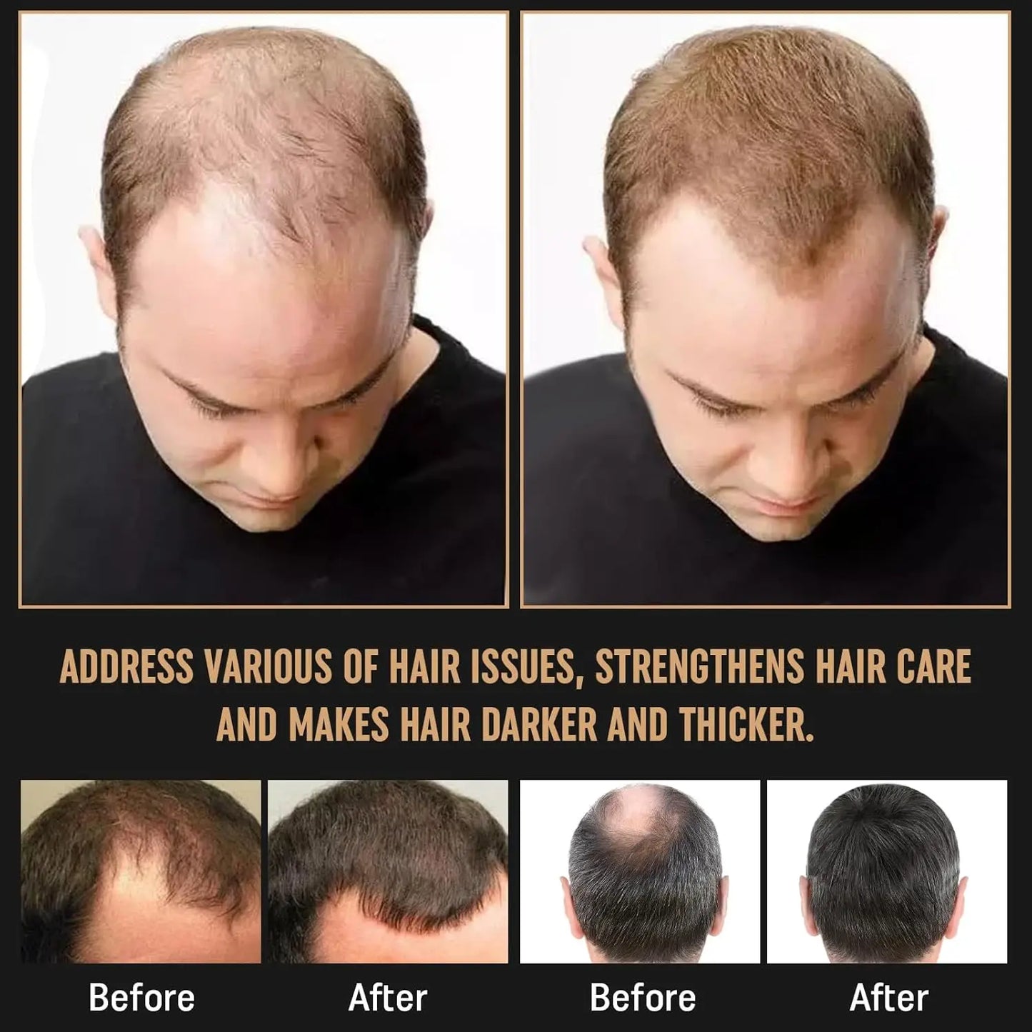 Root Activator Shampoo - Hair Growth Root Activator Shampoo for Men and Women - Natural Formula for Hair Loss and Thinning Hair