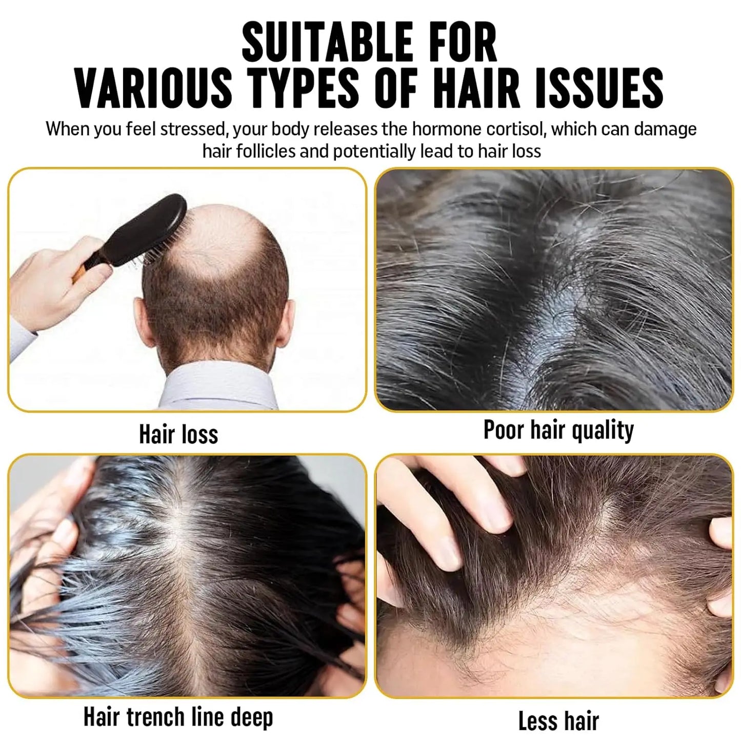 Root Activator Shampoo - Hair Growth Root Activator Shampoo for Men and Women - Natural Formula for Hair Loss and Thinning Hair