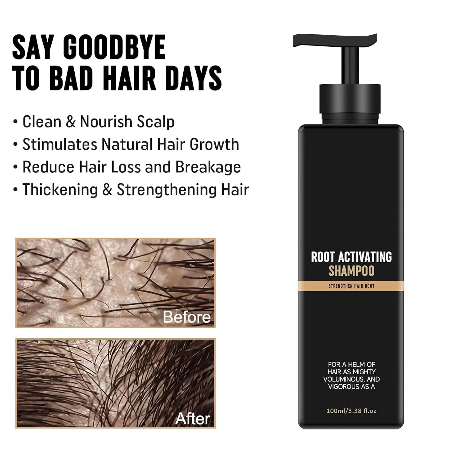 Root Activator Shampoo - Hair Growth Root Activator Shampoo for Men and Women - Natural Formula for Hair Loss and Thinning Hair